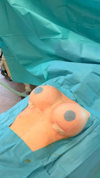 Instagram post from dr.fouquet. This post is in position 4.